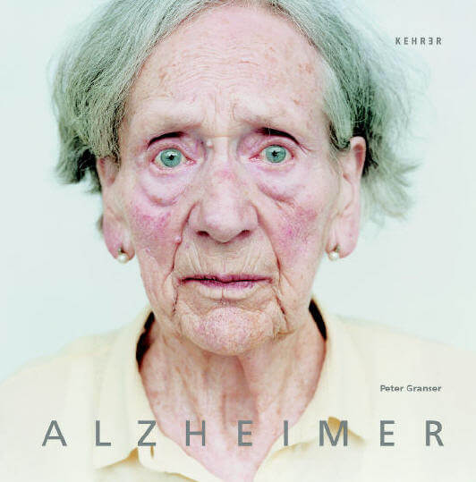 Fotografía de la serie Alzheimer de Peter Granser sobre personas con demencia