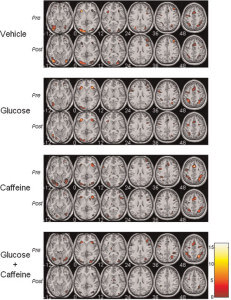 El contraste muestra las áreas con una actividad cerebral significativa