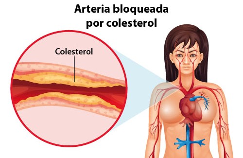 Imagen: mejorconsalud.com