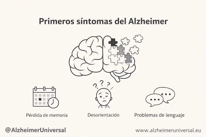 primeros síntomas del Alzheimer