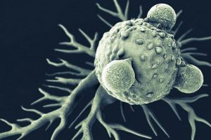 Anticiparse al Alzheimer (1era parte)
