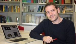 A estudio una nueva terapia con ondas ultrasónicas para tratar el Alzheimer