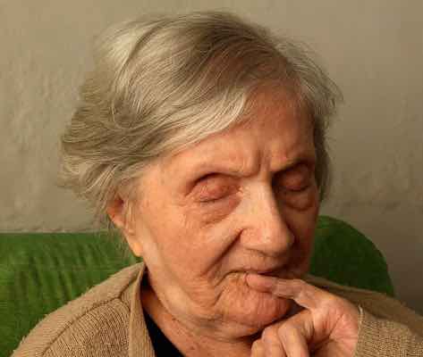 Preguntas que nos Hacemos Sobre el Alzheimer