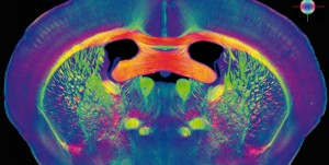cerebro-humano-300x151-human-brain-project
