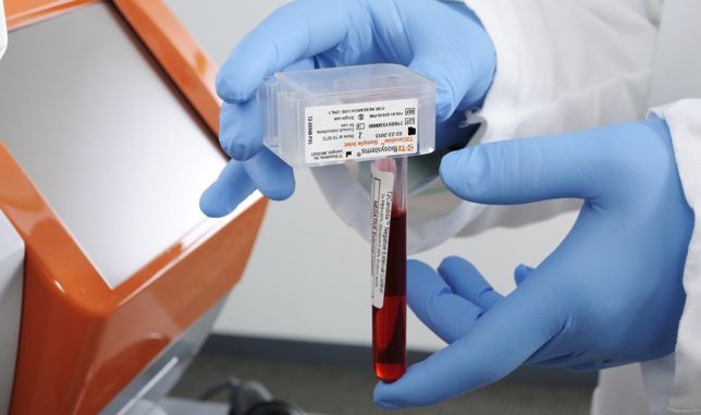 blood_test-670xXx80