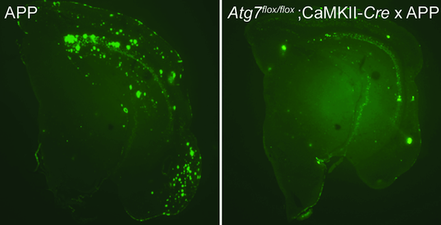 La formación de las placas de beta amiloides en alzhéimer depende de la autofagia. PER NILSSON, RIKEN alzheimer-cell-670xXx80_0987654321