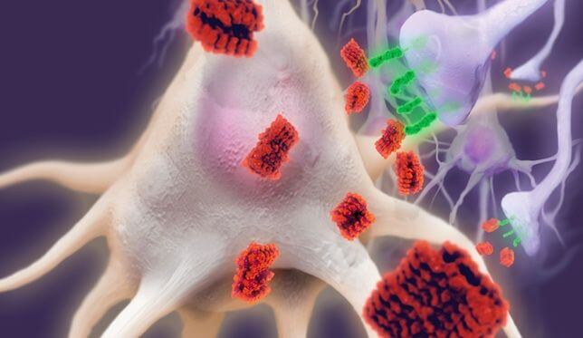 Partículas de la proteína tau adheridas a las neuronas Imagen: ABC.es