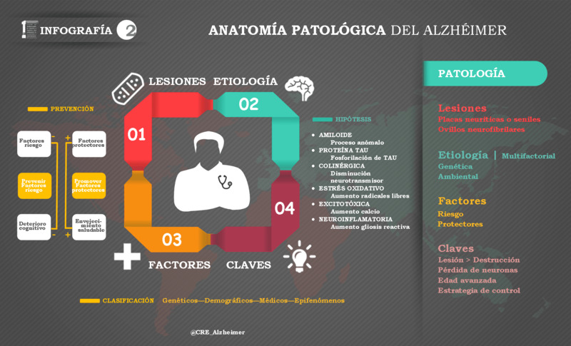 Excelentes Infografías del Alzheimer