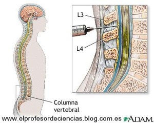 El líquido cefalorraquídeo de las personas que tienen problemas leves de memoria puede ayudar a identificar a los que luego desarrollarán la enfermedad de Alzheimer.