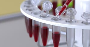Test de sangre en un laboratorio.Maxuser/Getty Images