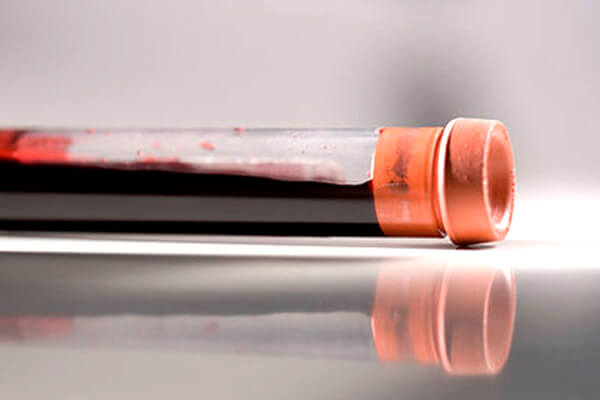 Proteínas Especializadas Alzheimer