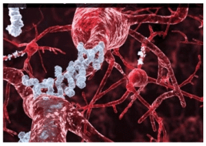 El alzhéimer se genera por la acumulación de la proteína β-Amiloide (Aβ) en el cerebro Imagen Cortesía: NASA