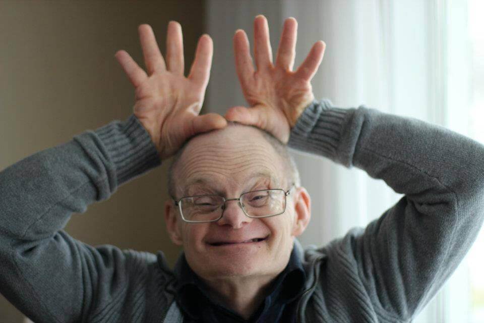 Alzheimer y Síndrome de Down