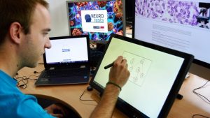 El grupo Visilab de la UCLM desarrolla una herramienta para evaluar el alzhéimer