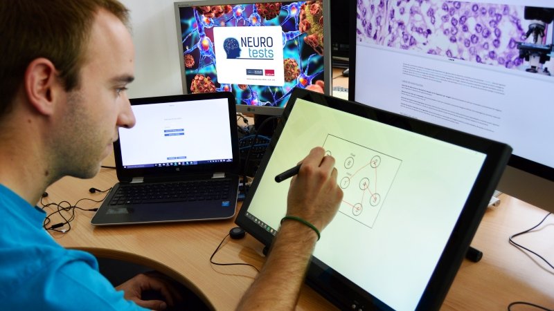 El grupo Visilab de la UCLM desarrolla una herramienta para evaluar el alzhéimer