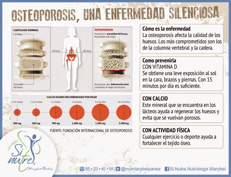 infografía Osteoporosis-1