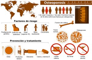 infografía Osteoporosis-3