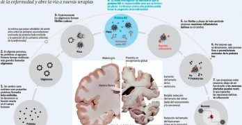 ASC la proteína clave en el progreso del Alzheimer