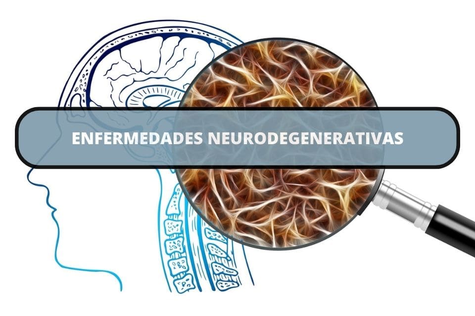 Enfermedades Neurodegenerativas: Qué Son, Tipos Y Causas • Alzheimer ...