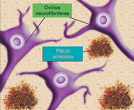 Imágenes del Cerebro