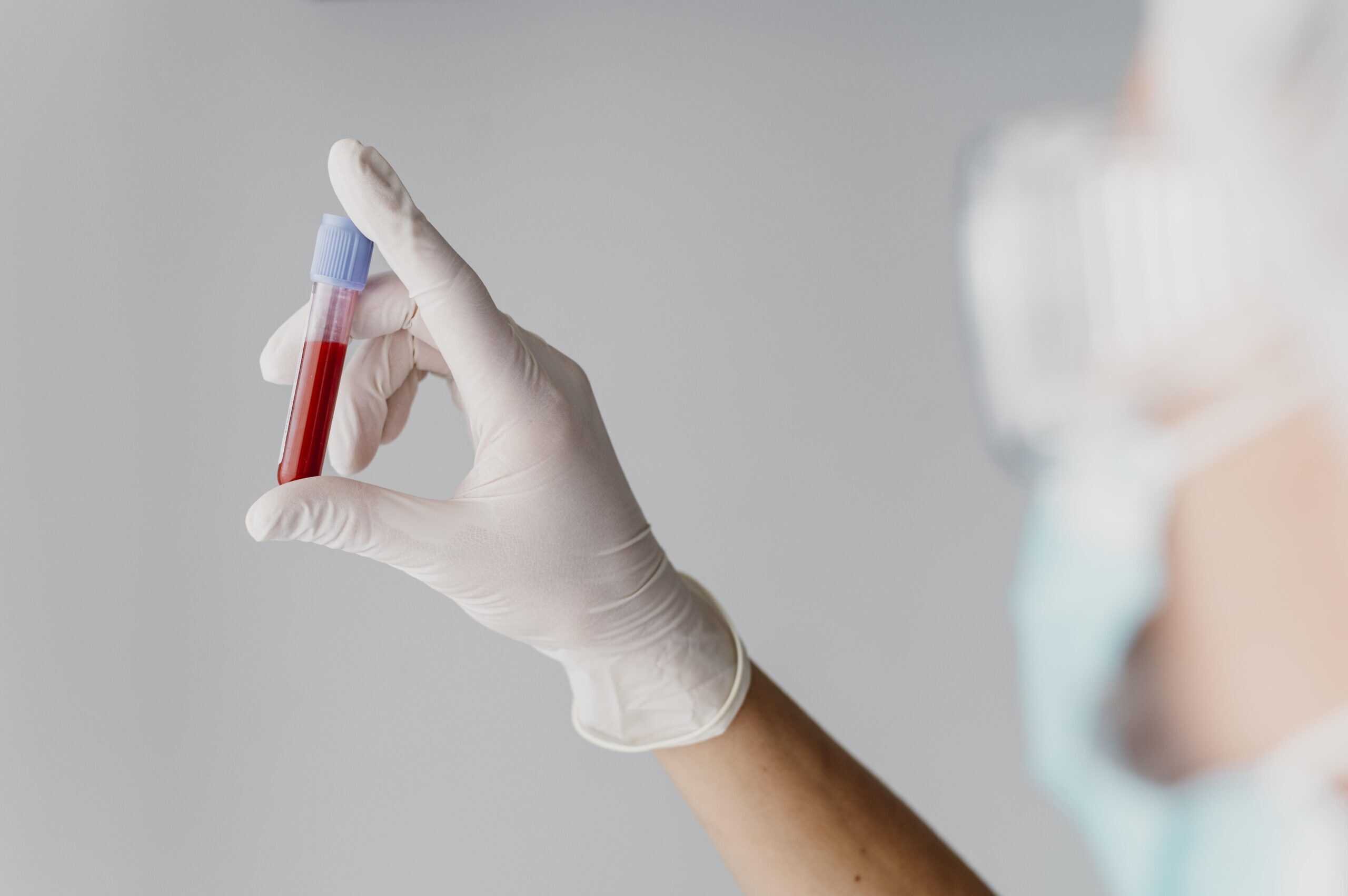 back-view-doctor-holding-blood-sample(1) Prueba de sangre Alzheimer