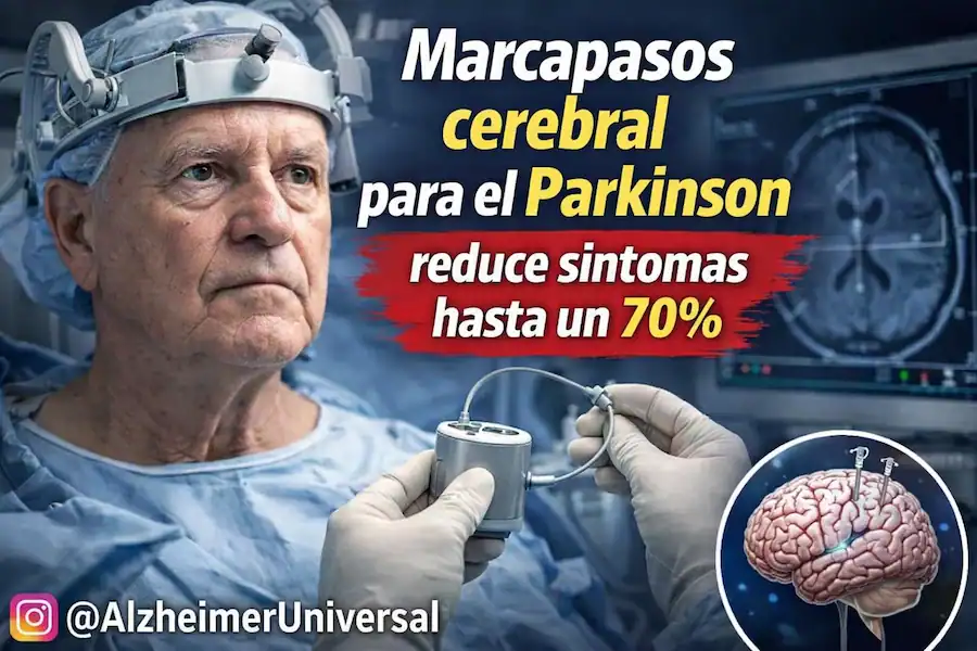 marcapasos cerebral para el Parkinson