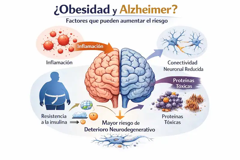 obesidad riesgo Alzheimer