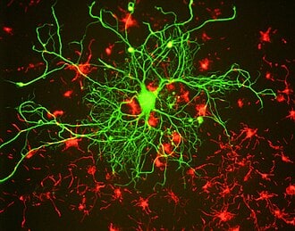 Entrenamiento cerebral y neuroplasticidad: neurona cortical observada mediante microscopía fluorescente