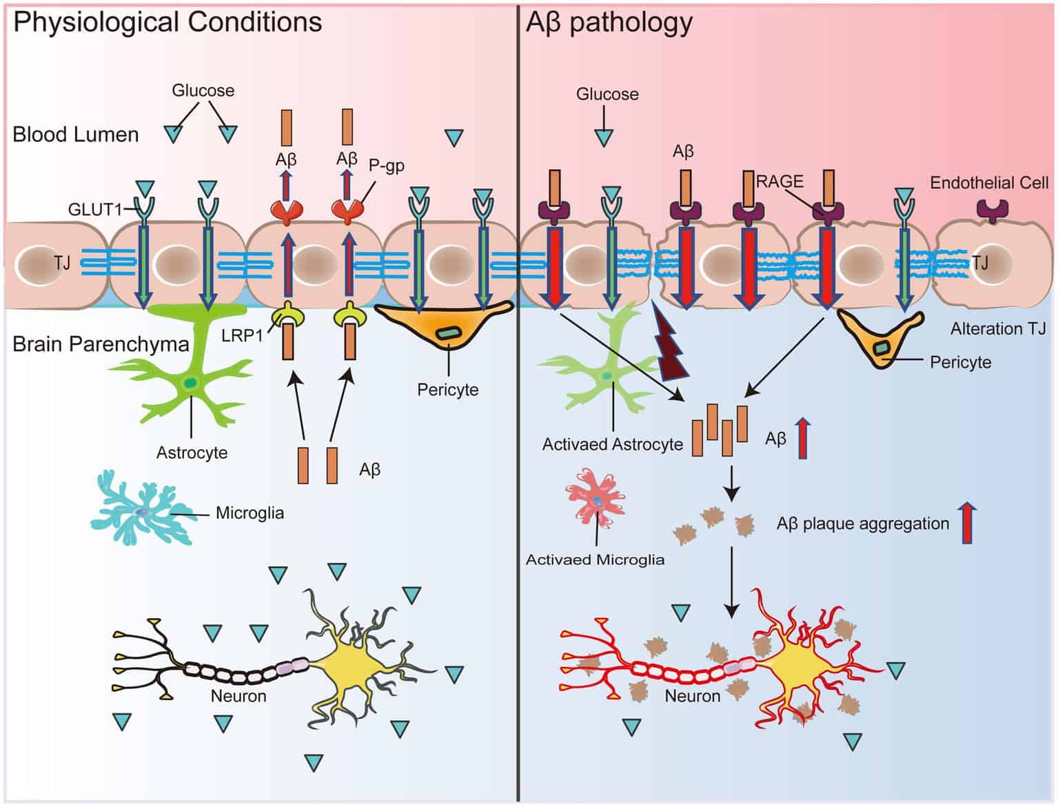 Alteraciones de la barrera hematoencefálica asociadas a la enfermedad de Alzheimer